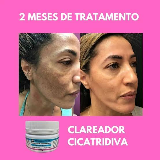 Clareador de Manchas Cicatridiva - 100% Natural